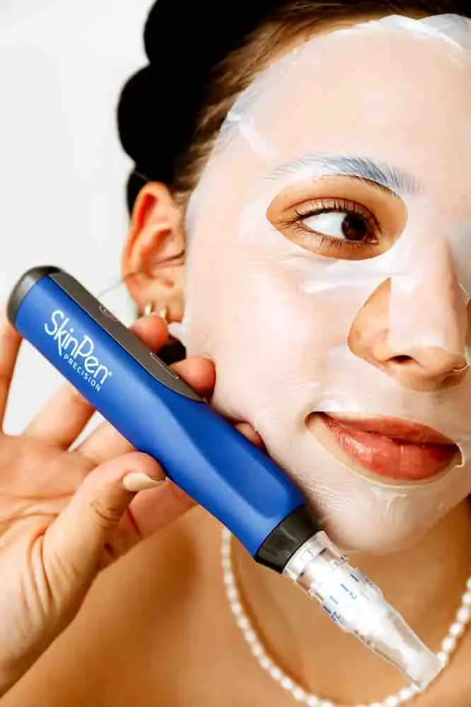 Microneedling