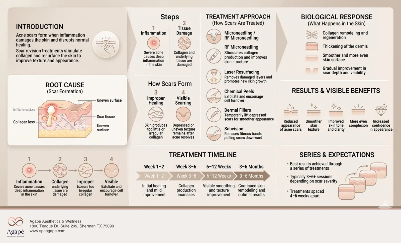 A detailed infographic outlining the steps and treatments for acne scar revision.