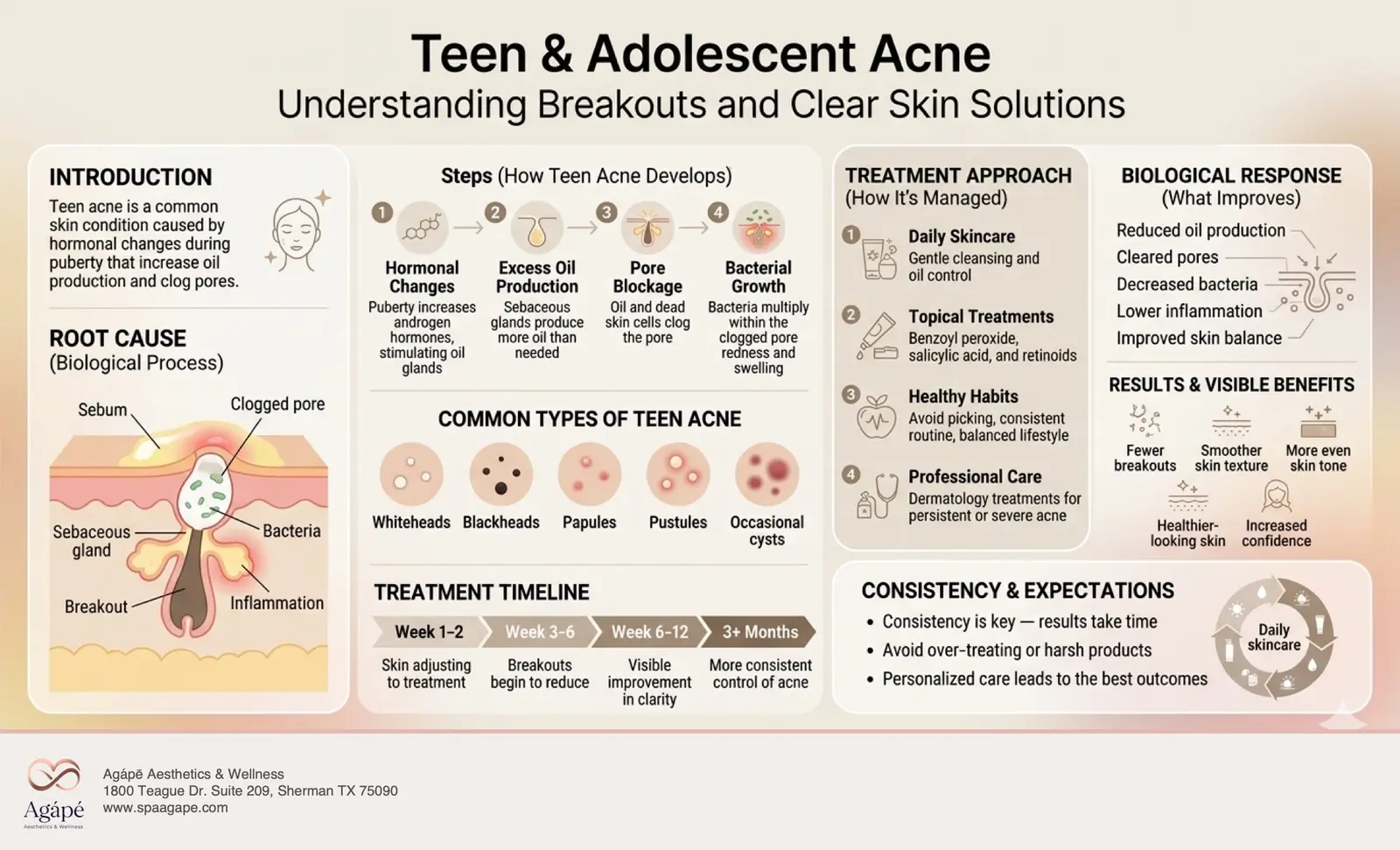 An infographic explaining teen and adolescent acne, including causes, treatment approaches, and expected results.