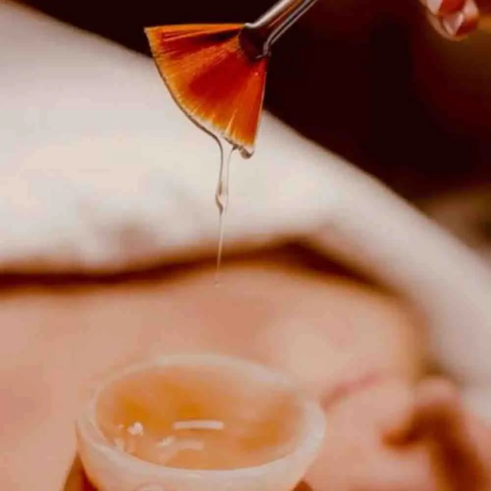 Customized Chemical Peels