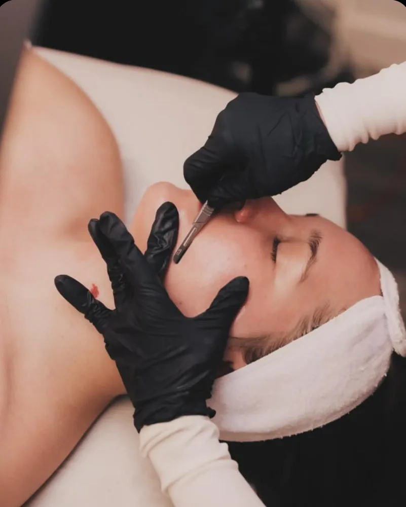Aesthetician performing a Dermaplaning Add-On treatment to remove dead skin and peach fuzz from a client's face.